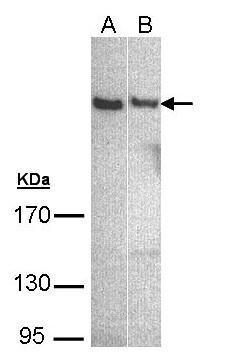 PLCH1 antibody [N2C1], Internal