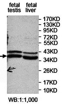 PLCXD1 Rabbit Polyclonal Antibody