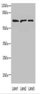 PLCZ1 Antibody