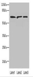 PLCZ1 antibody