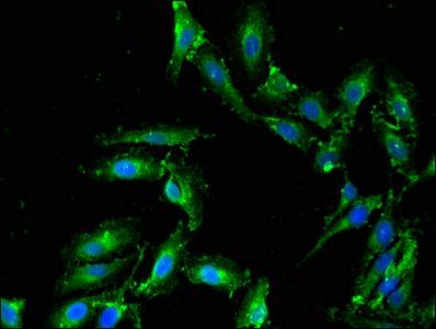 PLD1 antibody