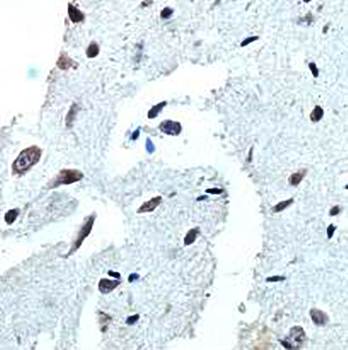 PLD3 Rabbit Polyclonal Antibody