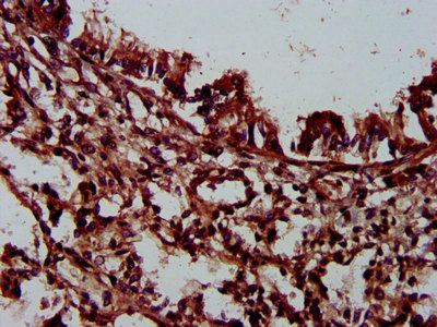 PLEC Antibody