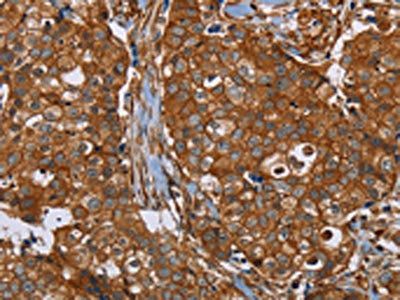 PLEC Antibody