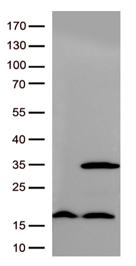 Pleckstrin (PLEK) antibody