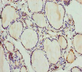PLEKHA1 Antibody