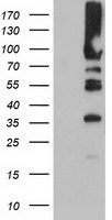 PLEKHA3 Antibody