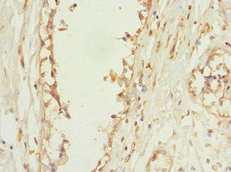 PLEKHF2 Antibody