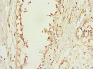 PLEKHF2 antibody