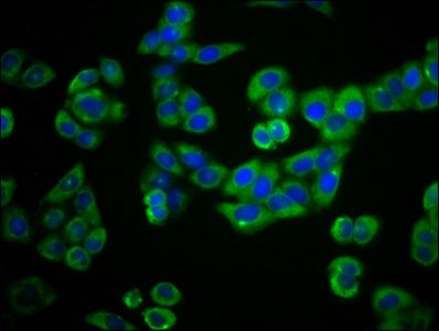 PLEKHG5 Antibody