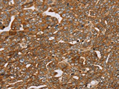 PLEKHG6 Antibody