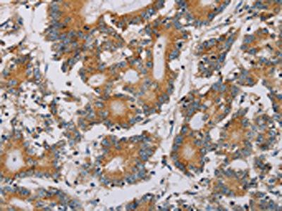 PLEKHG6 Antibody