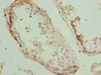 PLEKHJ1 Antibody