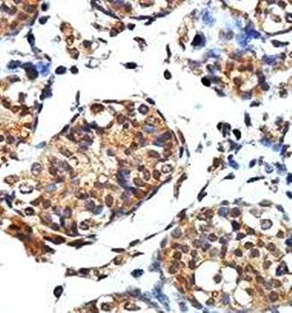 PLEKHJ1 Rabbit Polyclonal Antibody
