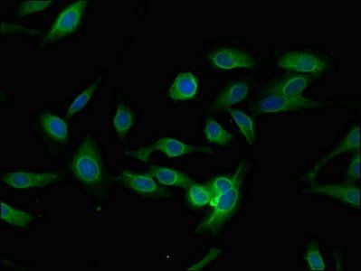 PLEKHO1 Antibody