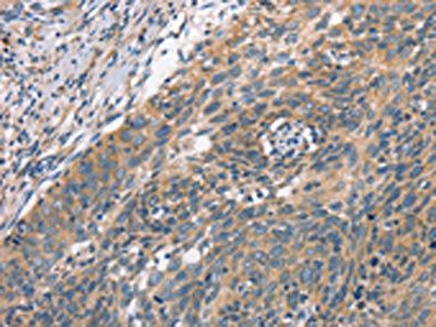 PLEKHO1 Antibody