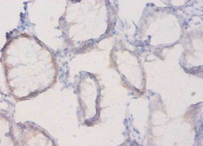 Plexin-A1 antibody