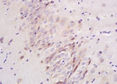 Plexin A1 Rabbit Polyclonal Antibody