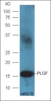 PLGF antibody