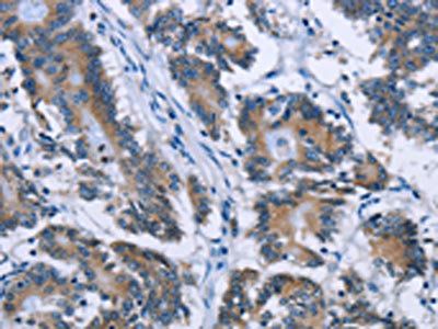 PLIN1 Antibody