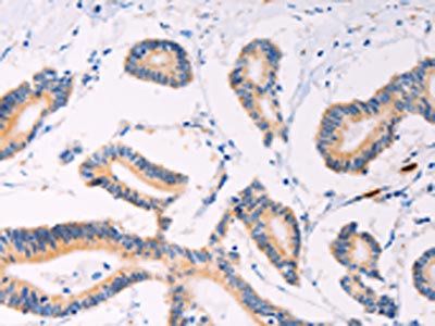 PLIN2 Antibody