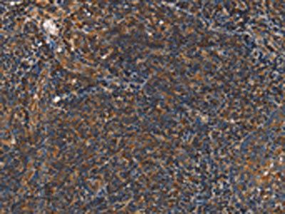PLIN2 Antibody