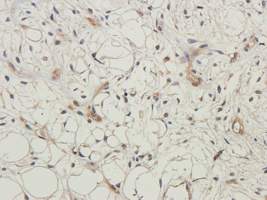 PLK1 Rabbit Polyclonal Antibody