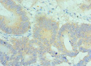 PLK2 Antibody