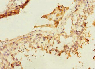 PLK3 Antibody