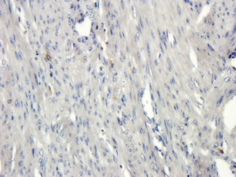 PLK4 Rabbit Polyclonal Antibody