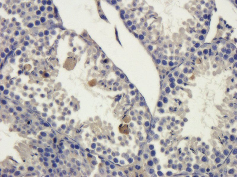 PLK4 Rabbit Polyclonal Antibody