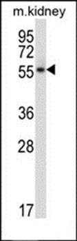 Plk5 antibody