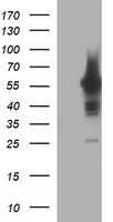 PLPBP Antibody