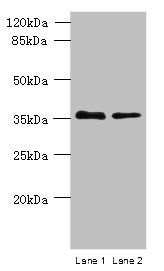 PLPP2 antibody