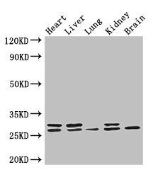 PLPP3 Antibody