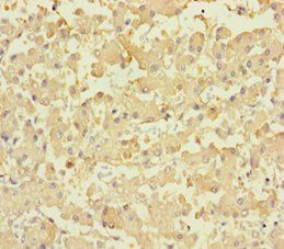PLPPR2 Antibody