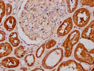 PLS1 Antibody