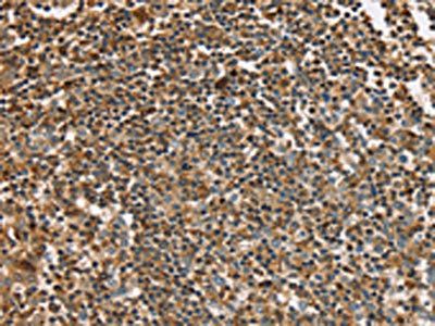 PLS3 Antibody