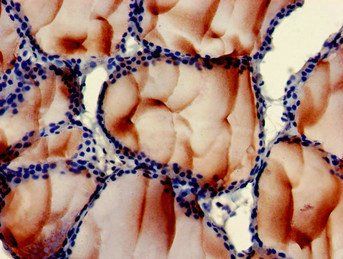 PLS3 Antibody