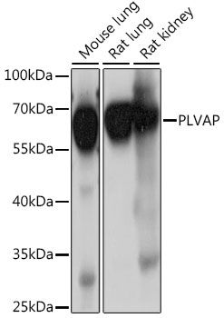 PLVAP antibody