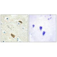 PLXDC1 Antibody