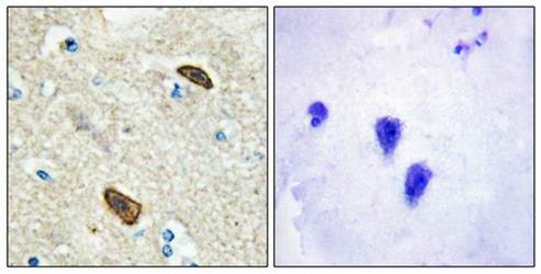 PLXDC1 Antibody