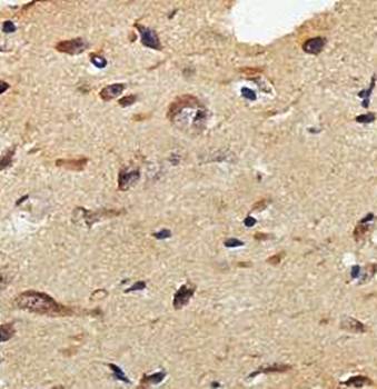 PLXDC1 Rabbit Polyclonal Antibody