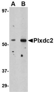 Plxdc2 Antibody