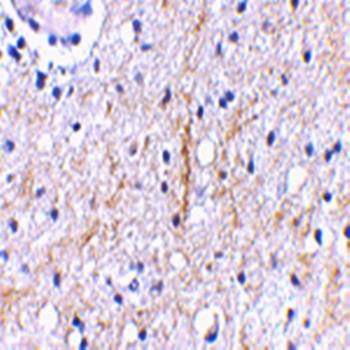 Plxdc2 Antibody