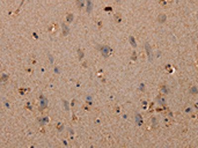 PLXNA1 Antibody