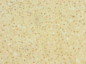 PLXNA2 Antibody