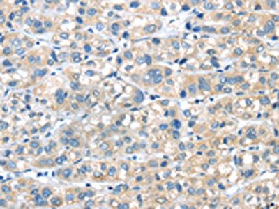 PLXNA2 Antibody