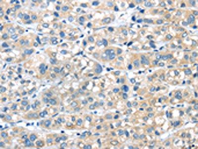 PLXNA2 antibody