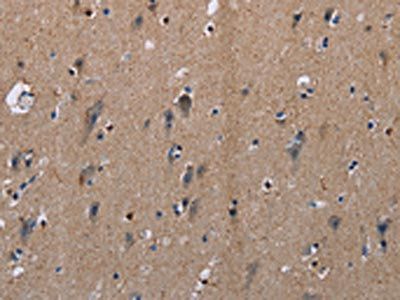 PLXNA2 Antibody